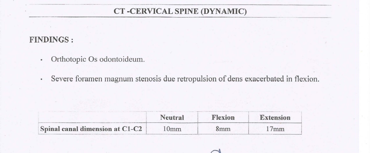 CT scan report of the cervical spine