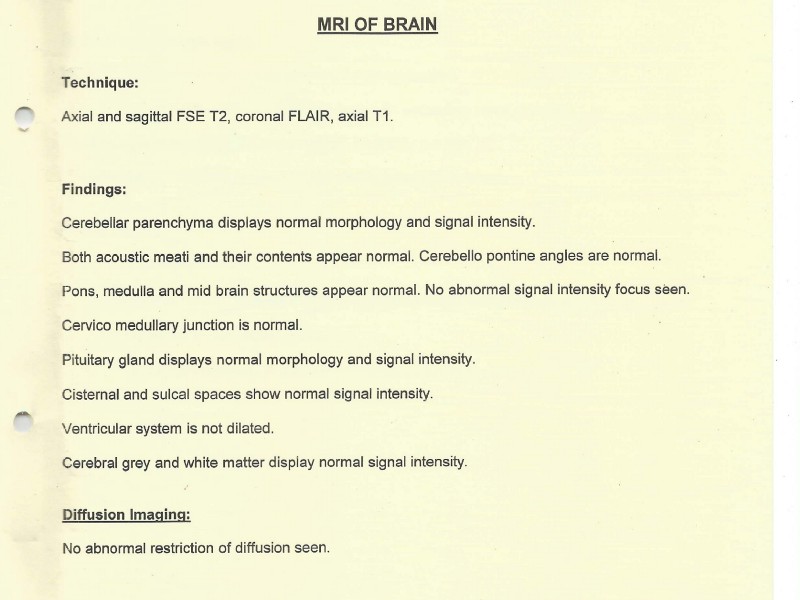 MRI report of brain