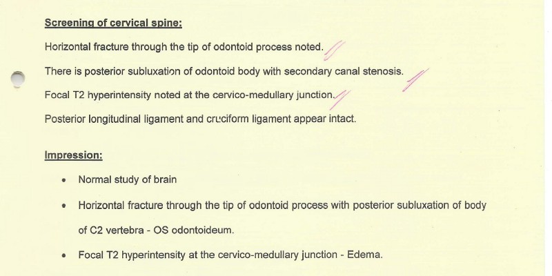 MRI report of spine